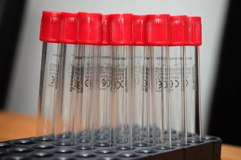 A rack of red-top blood collection tubes